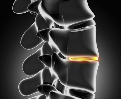 http=//www.sdchhjgc.com/img/ad/original/2014/04/11/477/ln4/7ul/I1_l6RE2E1397201981454.jpg http=//www.sdchhjgc.com/img/ad/original/2014/04/11/477/ln4/7ul/I1_l6RE2E1397201981454.jpg